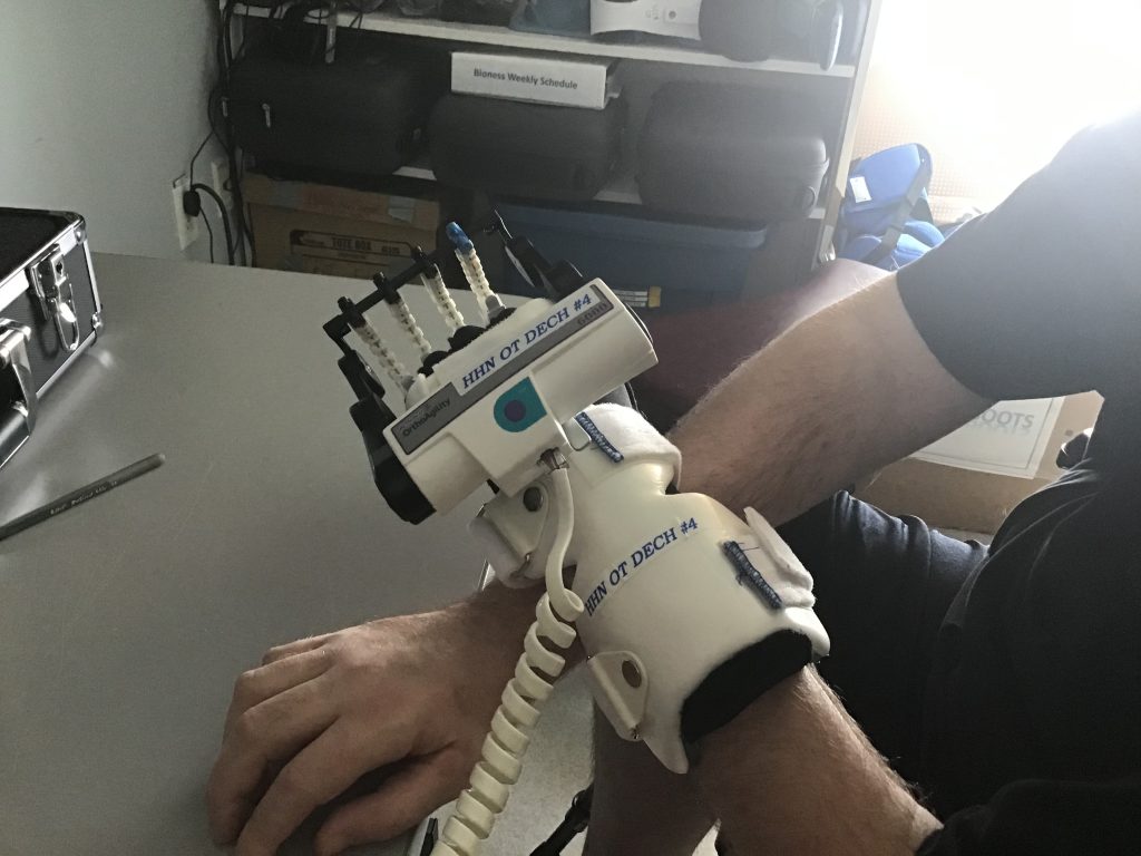 Hand CPM Machine Medical Device Continuous Passive Motion Fingers - Jamie Boyle Guillain Barre Syndrome at Stan Cassidy Rehabilitation Centre Fredericton NB