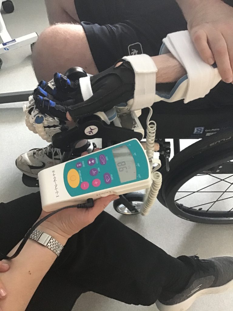 Hand CPM Machine Medical Device Continuous Passive Motion Fingers - Jamie Boyle Guillain Barre Syndrome at Stan Cassidy Rehabilitation Centre Fredericton NB