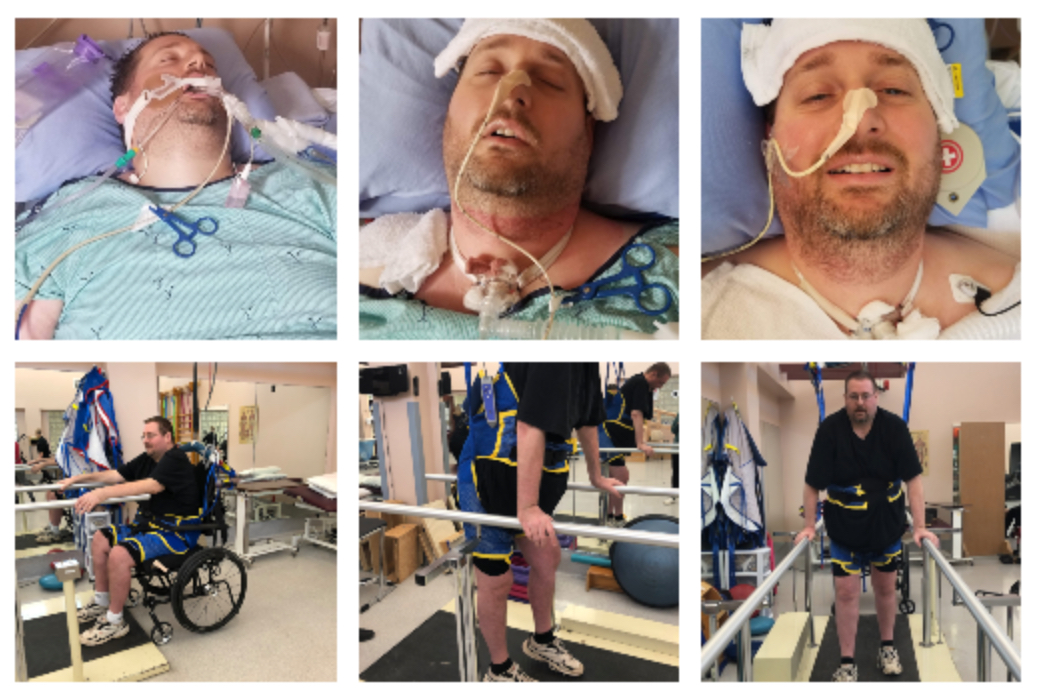 Guillain Barre Syndrome Day 214 - 7 Months Jamie Boyle GBS Recovery